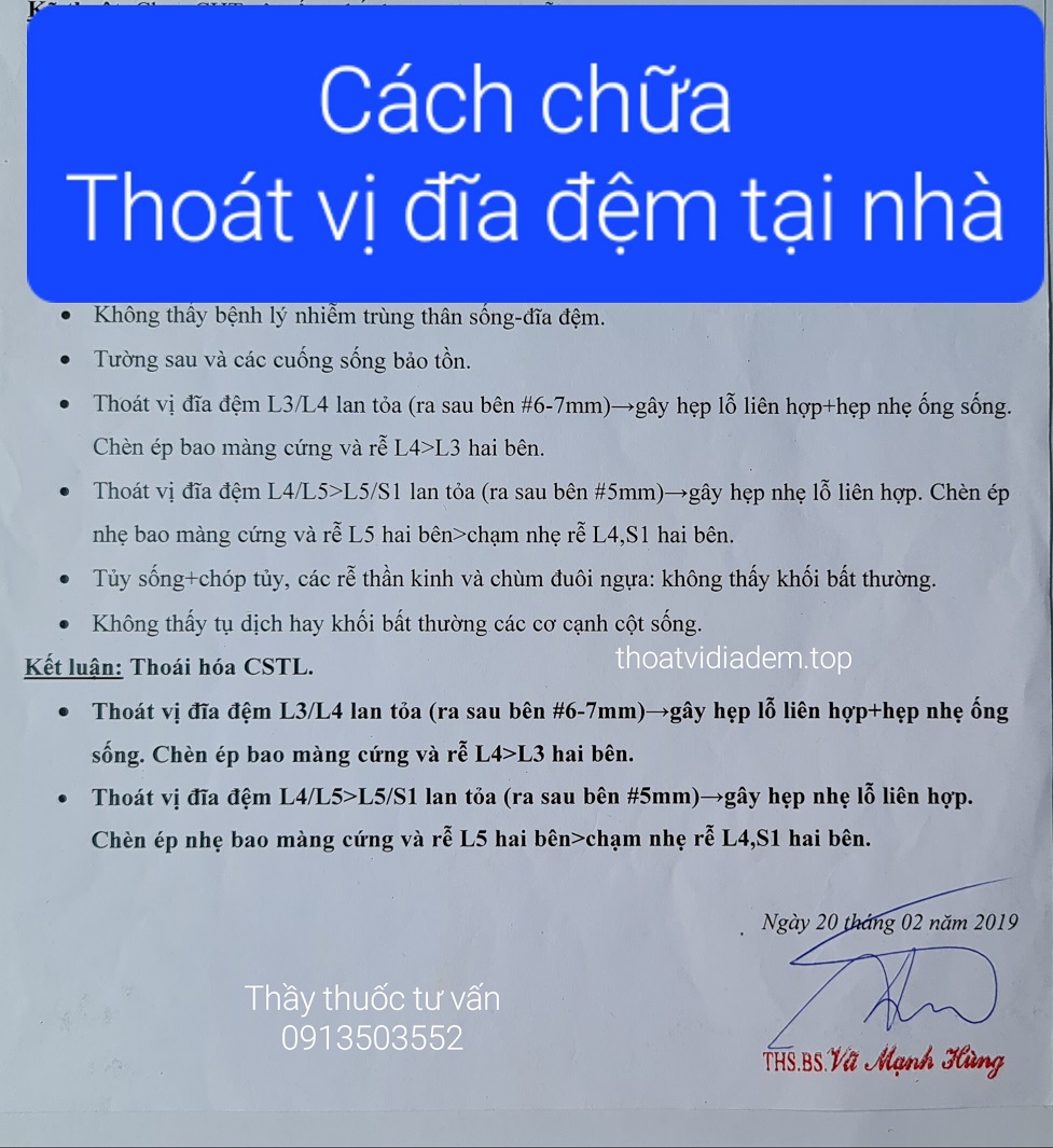Cách chữa thoát vị đĩa đệm tại nhà